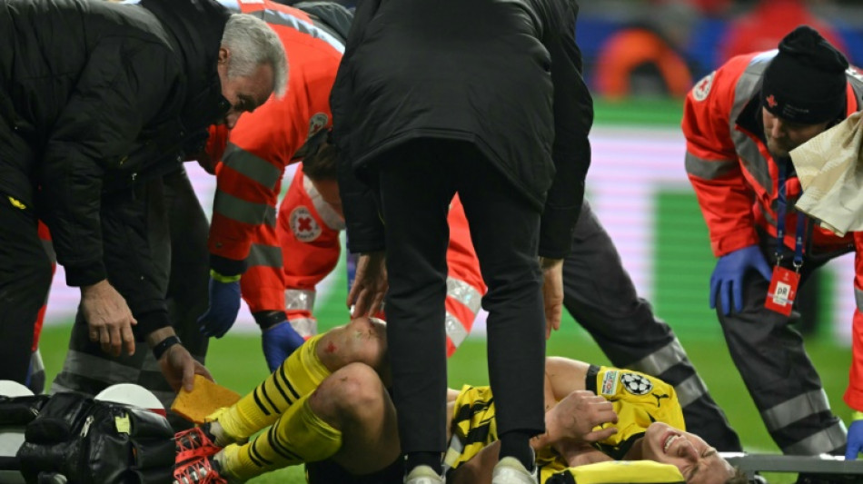 Borussia Dortmund confirma les&atilde;o no tornozelo de Scholotterbeck