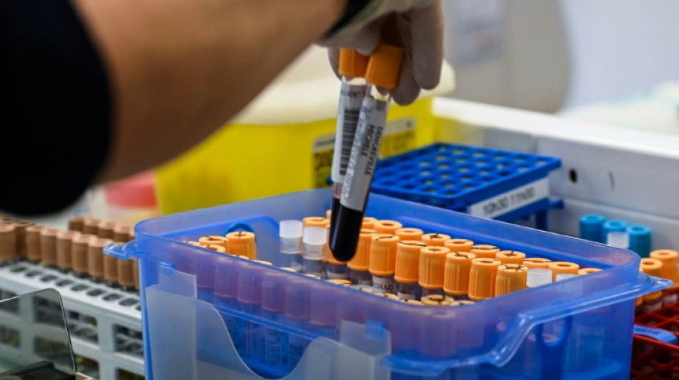 Tests ADN en acc&egrave;s libre: la question sensible d'une l&eacute;galisation relanc&eacute;e en France

