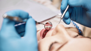 ANSA/ Boom di malattie delle gengive in Italia, in aumento le cure soft