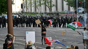 AFP-Fotograf in Los Angeles durch Gummigeschosse verletzt