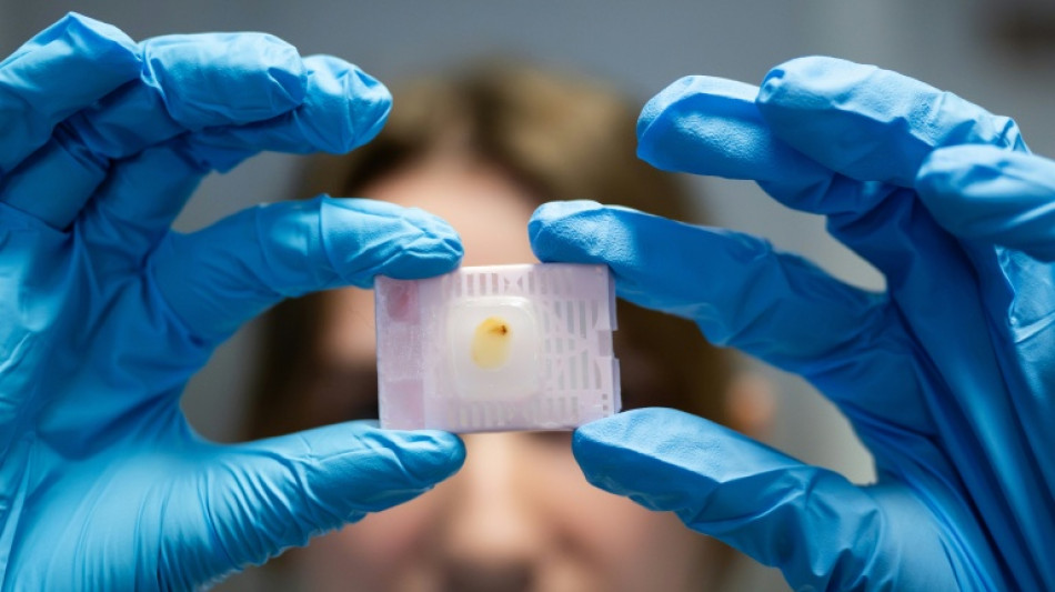Cancer du sein: &agrave; Nantes, des chercheurs traquent les failles des tumeurs chez les jeunes femmes